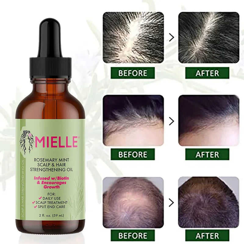 Mielle Hair Growth Essential Oil