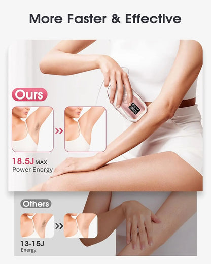 SilkySmooth IPL Epilator